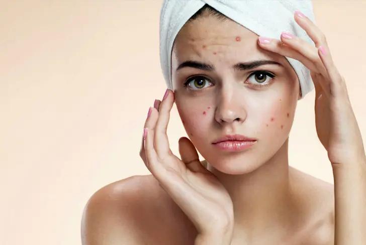 Foto:&nbsp;Fundación Mexicana para la Dermatología