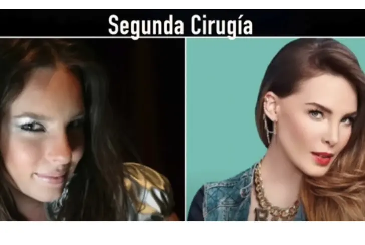 Segunda cirugía de Belinda