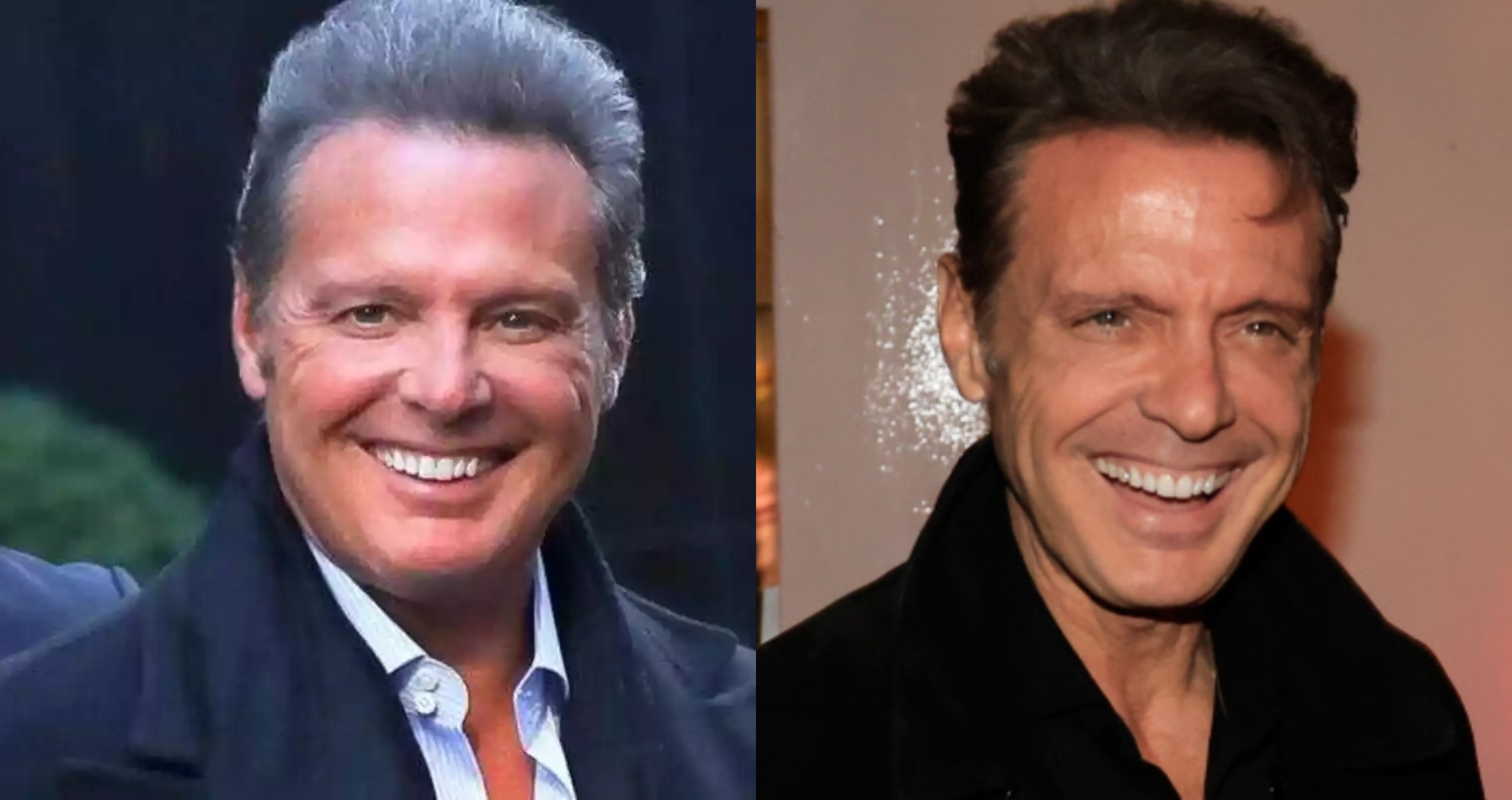 Luis Miguel antes y después